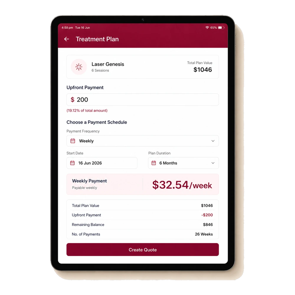 Service Cue Consult App — split the plan into weekly payments